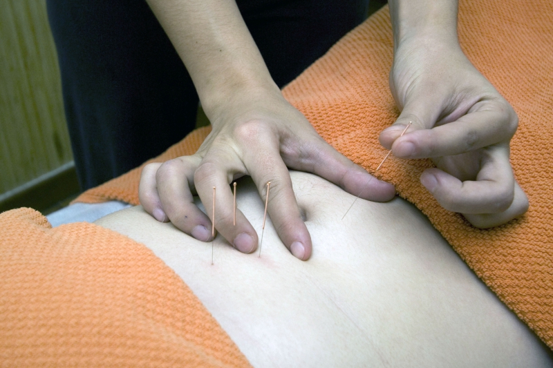 osteopathe-HYERES-min_acupuncture-4175625